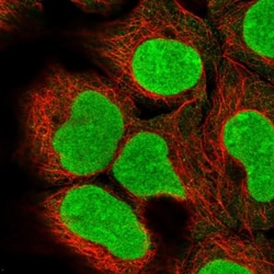 DCUN1D5 Antibody, Novus Biologicals 0.1mL; Unlabeled:Antibodies, Polyclonal